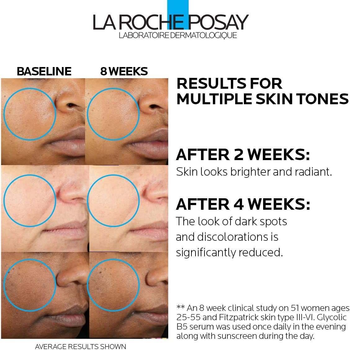 La Roche-Posay Glycolic B5 Serum – Exfoliación Suave