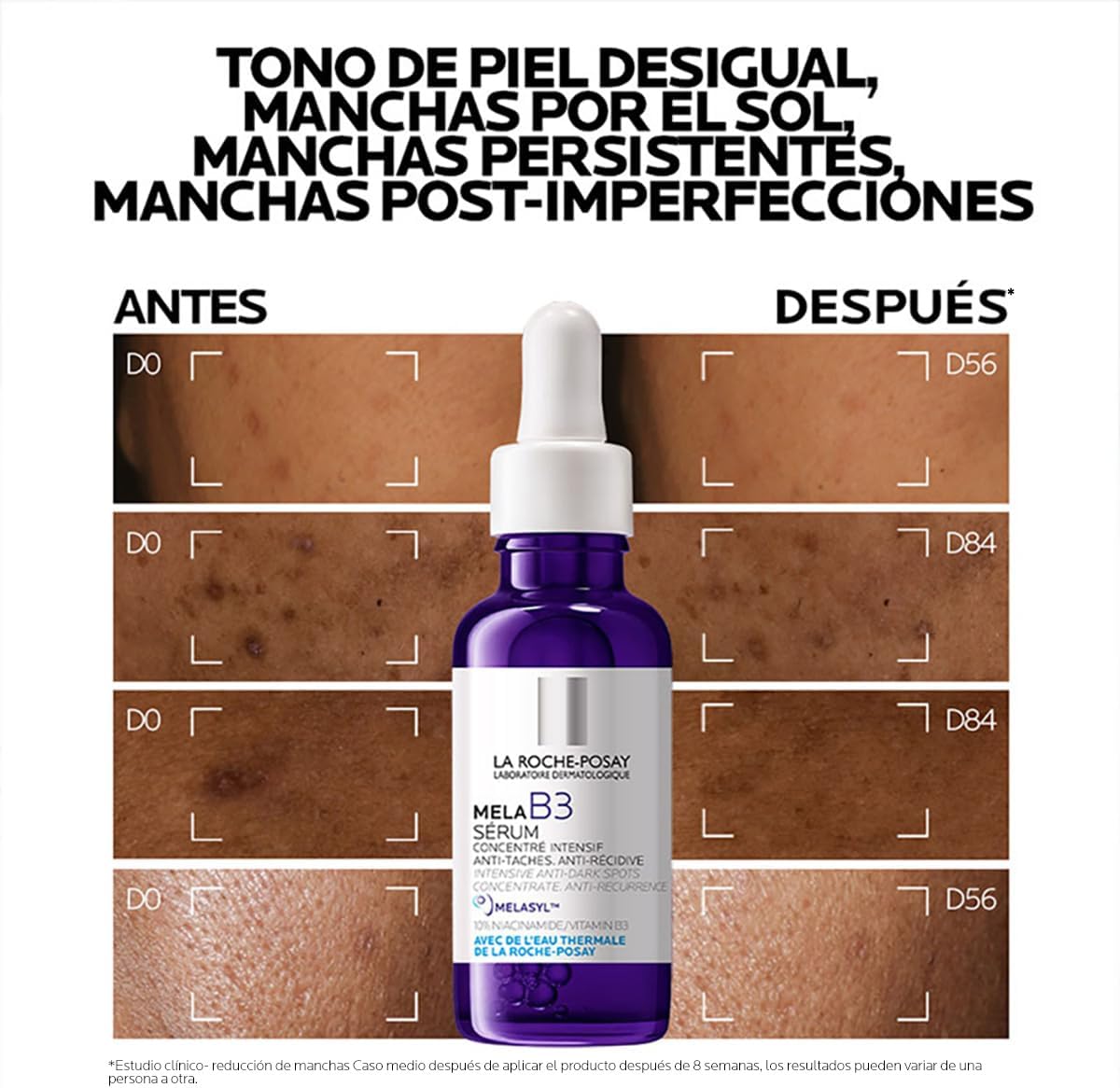 La Roche-Posay Mela B3 Serum – Manchas y Tono Uniforme